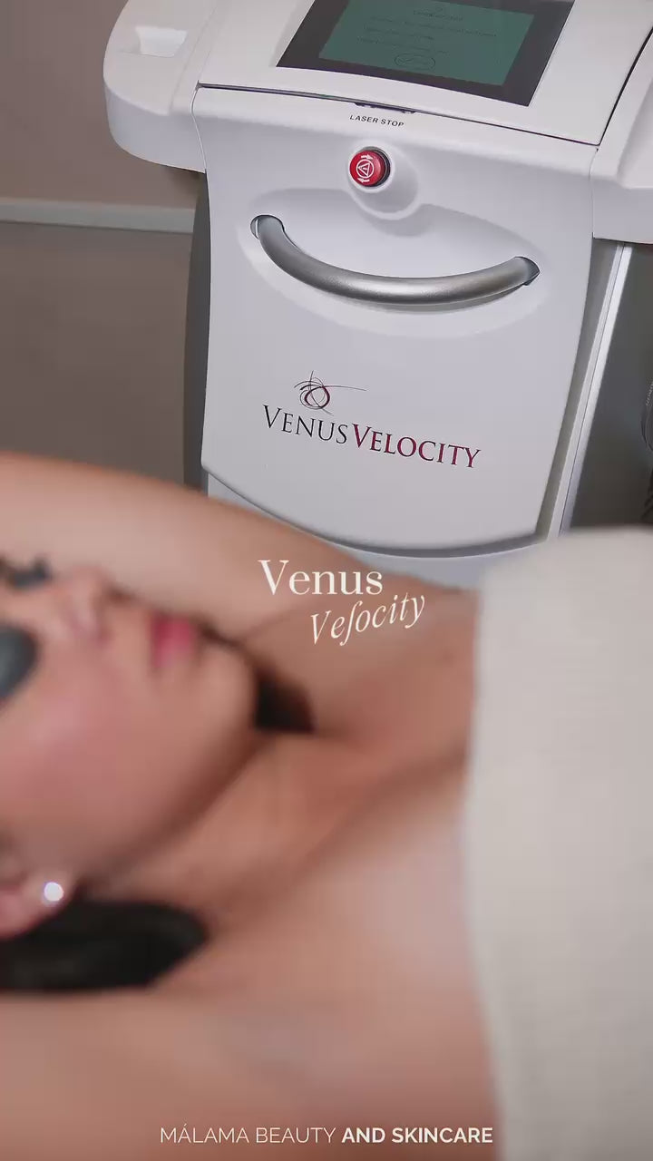 Venus Velocity — Depilación Láser