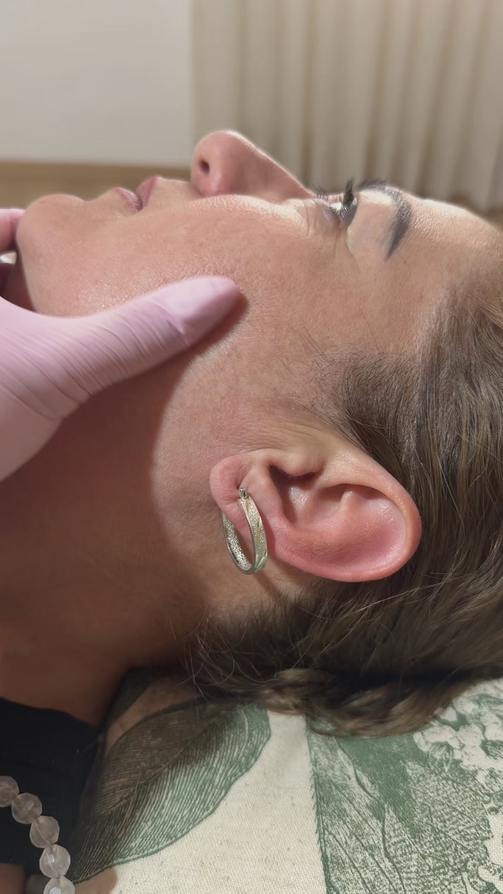 Venus Versa — IPL Láser