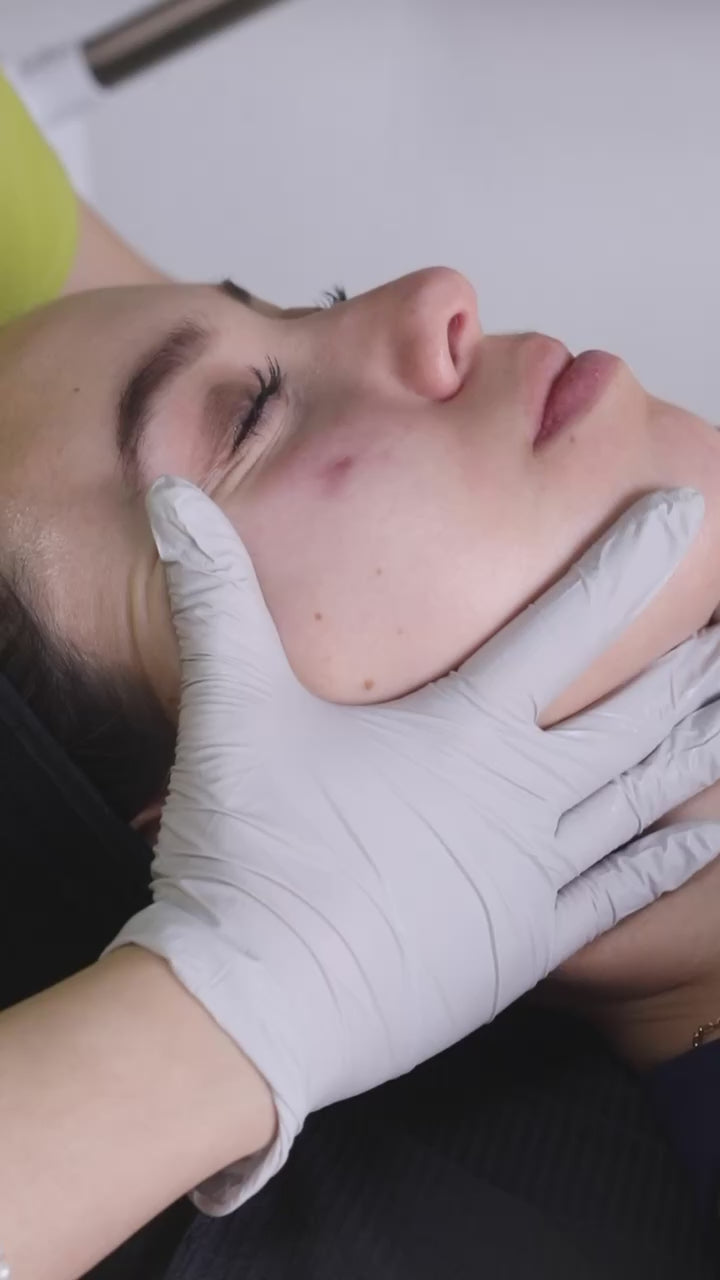 Limpieza Facial Profunda